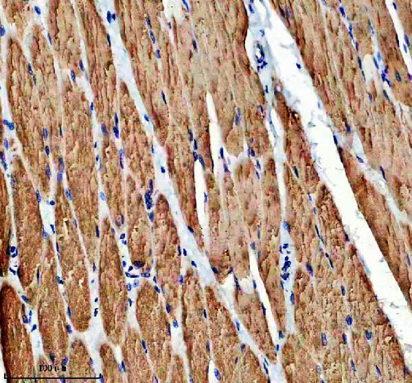 IHC analysis of FBXO40 using anti-FBXO40 antibody (A13273-1)