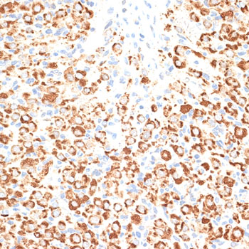 a13280 klhl9 primary antiboties ihc testing 2
