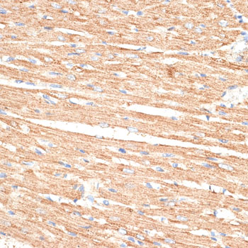 a13280 klhl9 primary antiboties ihc testing 3