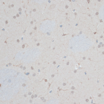 a13290 znf415 primary antiboties ihc testing 1