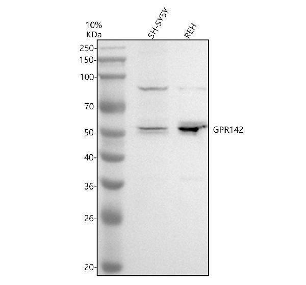 Western blot analysis of GPR142 using anti-GPR142 antibody (A13317-1)