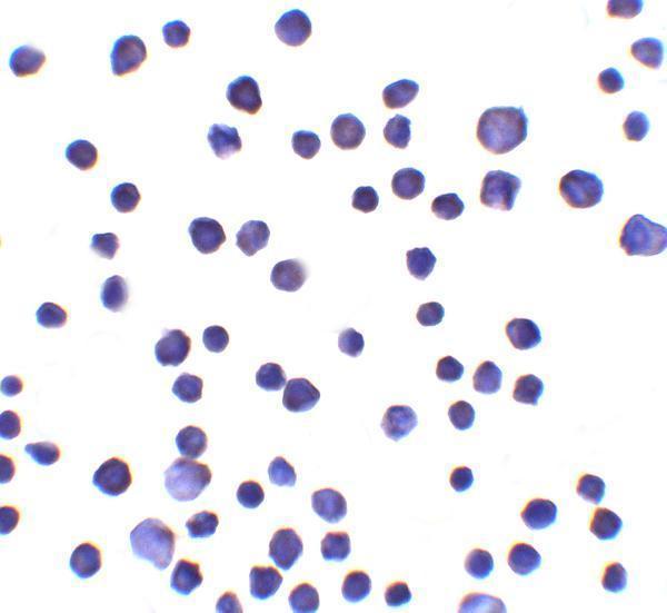 a13318 rnf121 primary antibodies icc testing 2