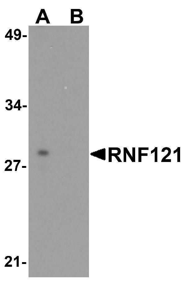 a13318 rnf121 primary antibodies wb testing 1