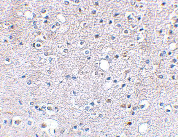 a13341 grik5 primary antibodies ihc testing 2