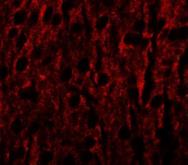 Immunofluorescence of RILPL1 in mouse brain cells with RILPL1 antibody at 20 μg/mL