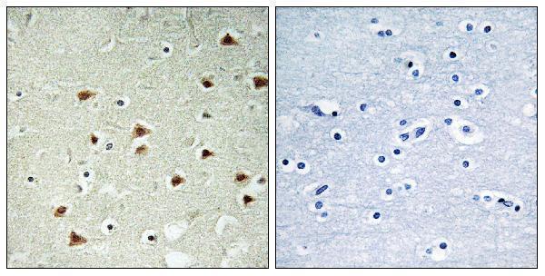 Immunohistochemistry analysis of paraffin-embedded human brain tissue, using ABHD14B Antibody
