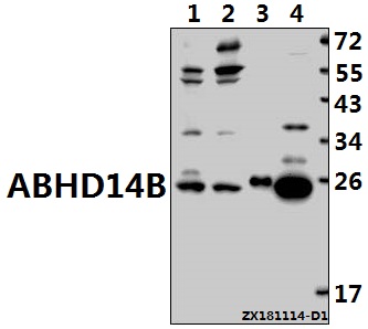 Western blot (WB) analysis of ABHD14B (L202) polyclonal antibody at 1:1000 dilution
Lane1:HCT116 whole cell lysate(40ug)
Lane2:L02 whole cell lysate(40ug)
Lane3:The Spleen tissue lysate of Mouse(10ug)
Lane4:The Kidney tissue lysate of Rat(30ug)