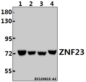 Western blot (WB) analysis of ZNF23 (Q185) pAb at 1:500 dilution
Lane1:A2780 whole cell lysate(40ug)
Lane2:The Testis tissue lysate of Mouse(40ug)
Lane3:Hela whole cell lysate(40ug)
Lane4:The Testis tissue lysate of Rat(40ug)