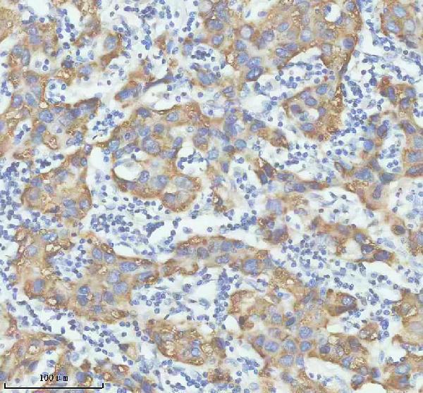 IHC analysis of DHRS1 using anti-DHRS1 antibody (A13366-1)