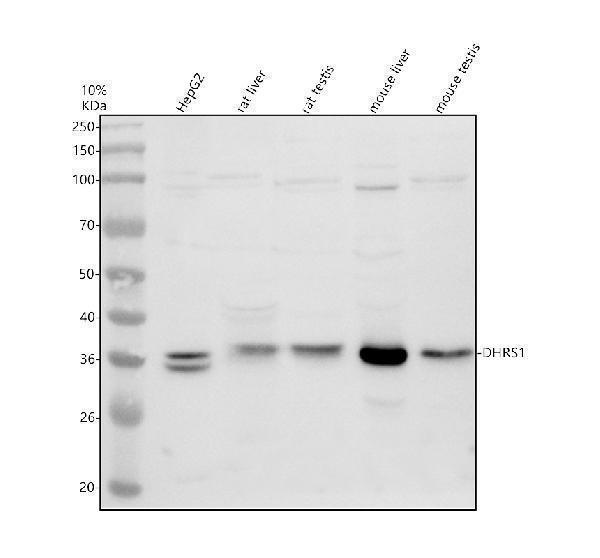 Western blot analysis of DHRS1 using anti-DHRS1 antibody (A13366-1)