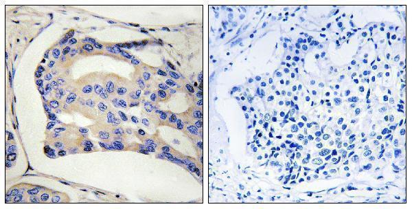 a13378 1 stk32c primary antibodies ihc testing 1
