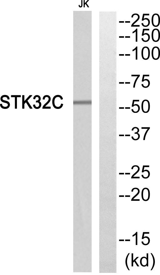 a13378 1 stk32c primary antibodies wb testing 2
