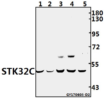 a13378 stk32c primary antiboties wb testing 1
