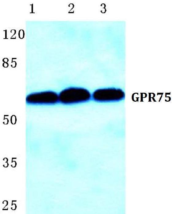a13384 1 gpr75 primary antiboties wb testing 1
