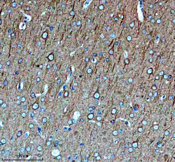 a13384 2 gpr75 primary antibodies ihc testing 1