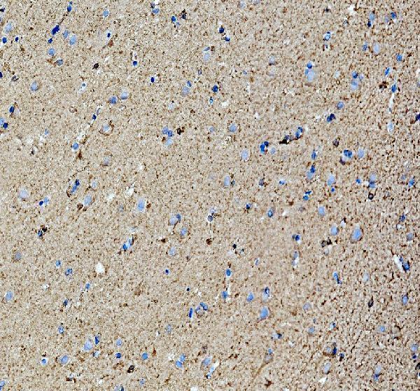 a13384 2 gpr75 primary antibodies ihc testing 2
