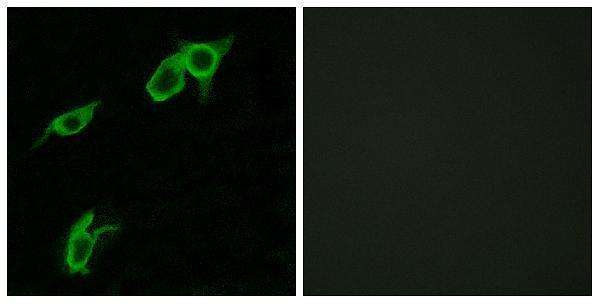 a13384 gpr75 primary antibodies if testing 1