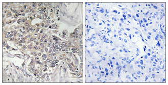 a13386 1 cyp4z1 primary antibodyes ihc testing 1