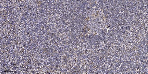 a13386 cyp4z1 primary antibodies ihc testing 1
