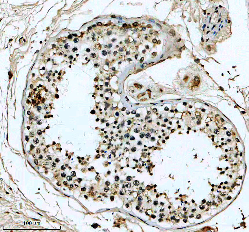 IHC analysis of MEI1 using anti-MEI1 antibody (A13387)