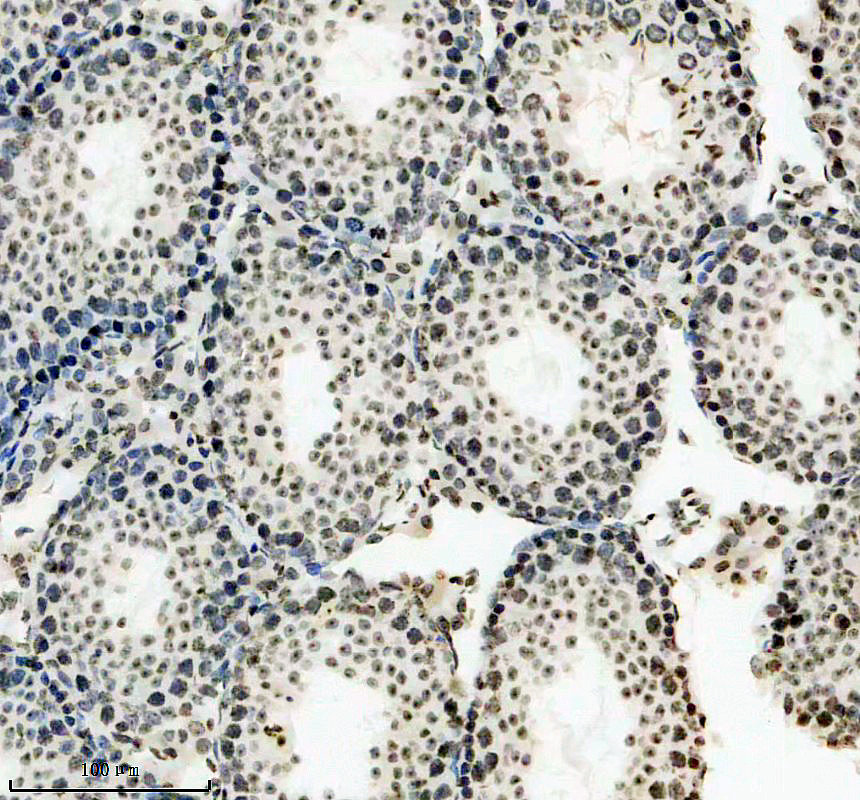 IHC analysis of MEI1 using anti-MEI1 antibody (A13387)