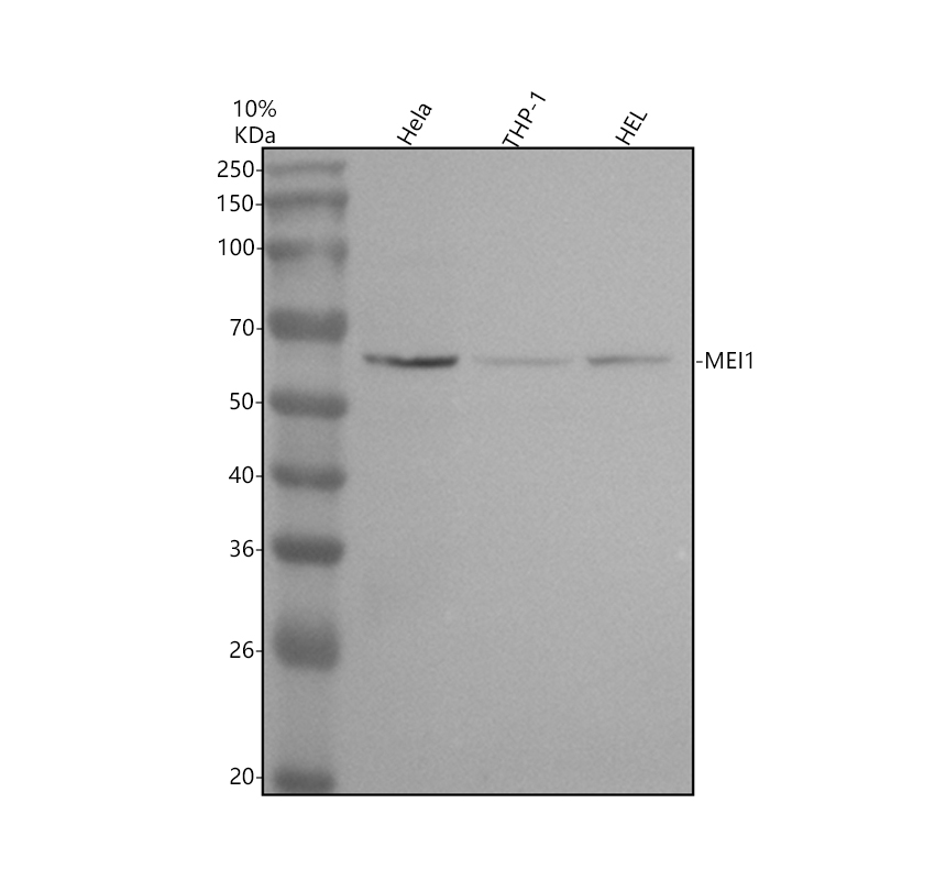 Western blot analysis of MEI1 using anti-MEI1 antibody (A13387)
