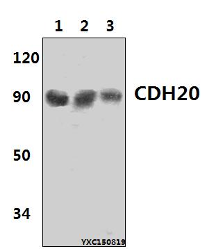 Western blot (WB) analysis of CDH20 polyclonal antibody at 1:500 dillution
Lane1:Hela whole cell lysate(40μg)
Lane2:The Liver tissue lysate of Rat(40μg)
Lane3:The Liver tissue lysate of Mouse (40μg)