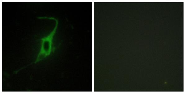 a13390 cdh20 primary antibodies if testing 1