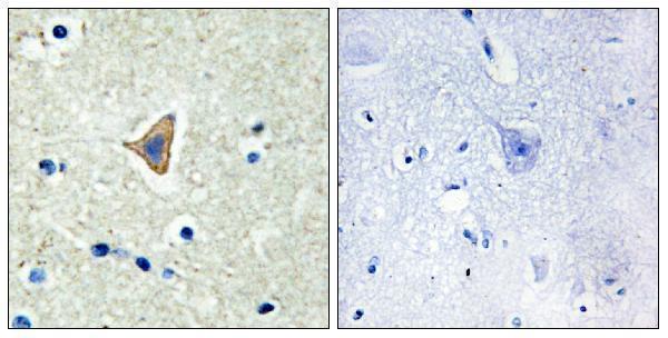 a13390 cdh20 primary antibodies ihc testing 2