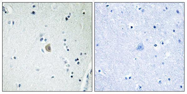 a13390 cdh20 primary antibodies ihc testing 3