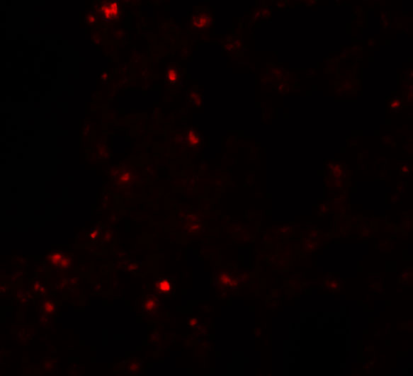 Immunofluorescence of ZSCAN4 in Rat Lung tissue with ZSCAN4 antibody at 20 μg/mL