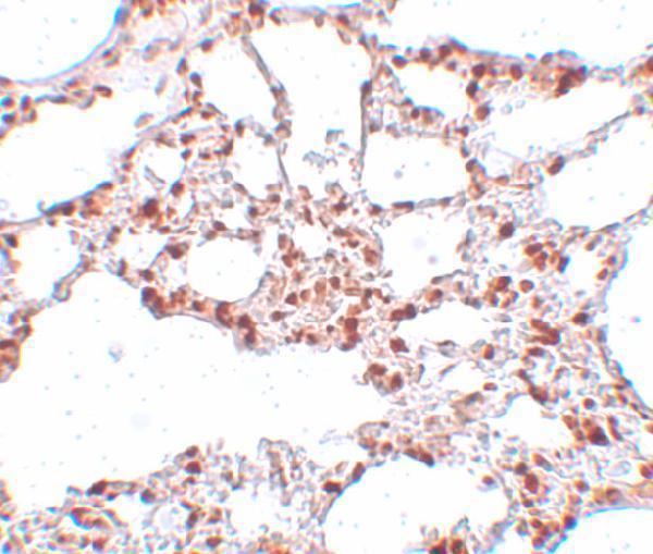 Immunohistochemistry of ZSCAN4 in rat lung tissue with ZSCAN4 antibody at 5 μg/mL