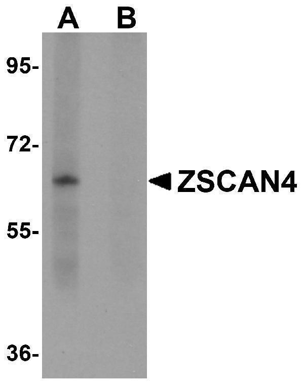 Western blot analysis of ZSCAN4 in mouse lung tissue lysate with ZSCAN4 antibody in (A) the absence and (B) presence of blocking peptide