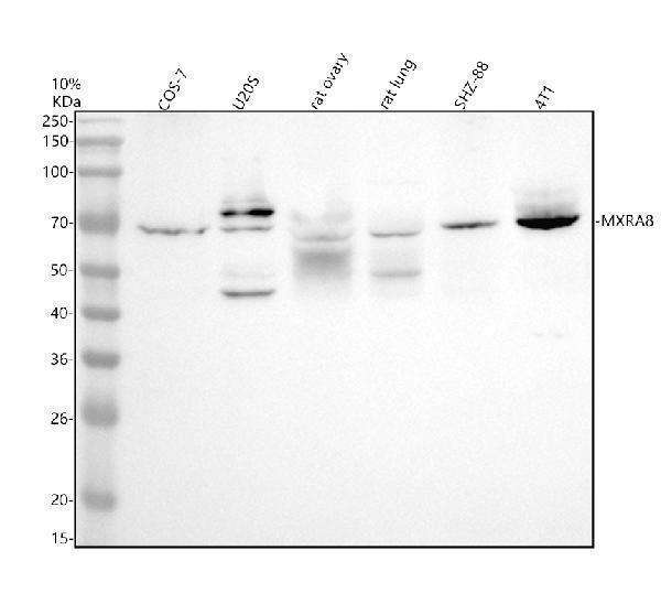 Western blot analysis of MXRA8 using anti-MXRA8 antibody (A13392-2)