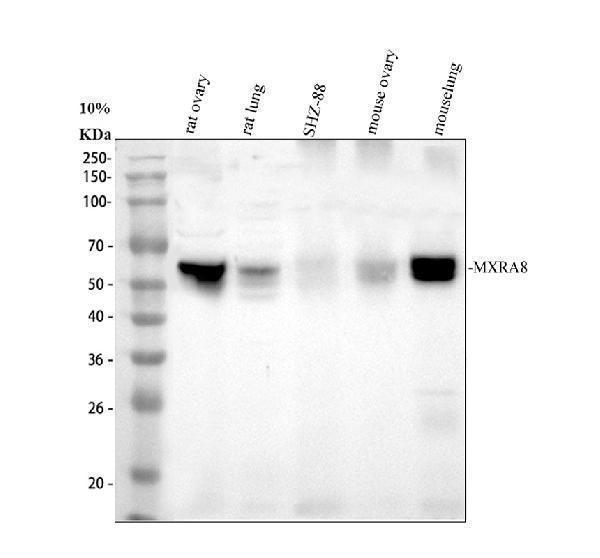 Western blot analysis of MXRA8 using anti-MXRA8 antibody (A13392-2)