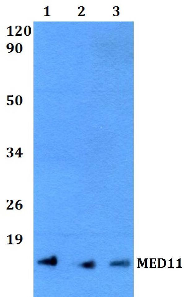 a13394 med11 primary antiboties wb testing 1