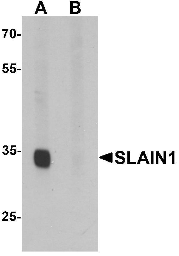 a13403 1 slain1 primary antibodies wb testing 1