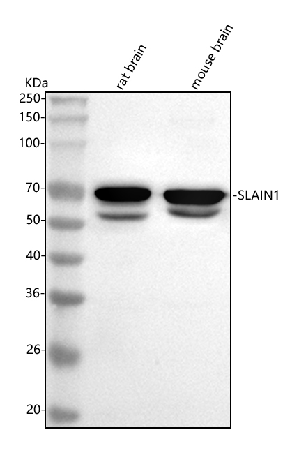 Figure 1. Western blot analysis of SLAIN1 using anti-SLAIN1 antibody (A13403-2). Electrophoresis was performed on a 5-20% SDS-PAGE gel at 70V (Stacking gel) / 90V (Resolving gel) for 2-3 hours. The sample well of each lane was loaded with 30 ug of sample under reducing conditions. Lane 1: rat brain tissue lysates, Lane 2: mouse brain tissue lysates. After electrophoresis, proteins were transferred to a nitrocellulose membrane at 150 mA for 50-90 minutes. Blocked the membrane with 5% non-fat milk/TBS for 1.5 hour at RT. The membrane was incubated with rabbit anti-SLAIN1 antigen affinity purified polyclonal antibody (Catalog # A13403-2) at 0.5 microg/mL overnight at 4°C, then washed with TBS-0.1%Tween 3 times with 5 minutes each and probed with a goat anti-rabbit IgG-HRP secondary antibody at a dilution of 1:5000 for 1.5 hour at RT. The signal is developed using an Enhanced Chemiluminescent detection (ECL) kit (Catalog # EK1002) with Tanon 5200 system. A specific band was detected for SLAIN1 at approximately 70 kDa. The expected band size for SLAIN1 is at 61 kDa.