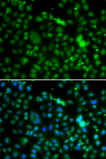 Immunofluorescence analysis of MCF-7 cells using NSUN6 antibody 