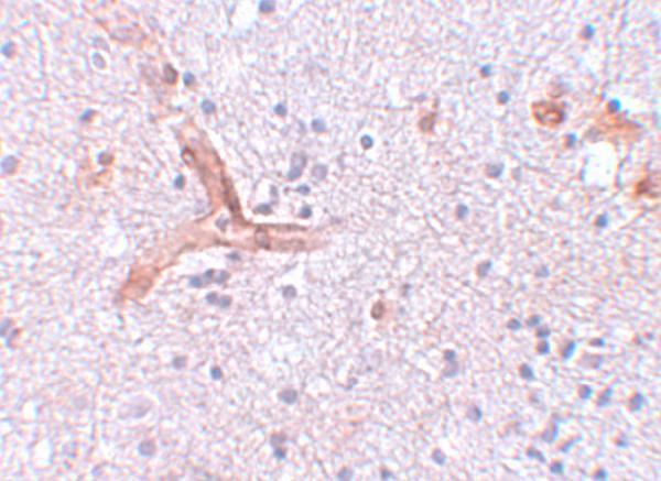 a13406 zc3h12c primary antibodies ihc testing 2