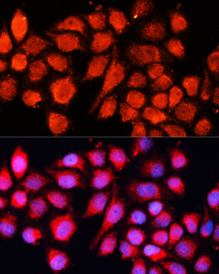 Immunofluorescence analysis of HeLa cells using MRPS28 Polyclonal Antibody  at dilution of 1:100 