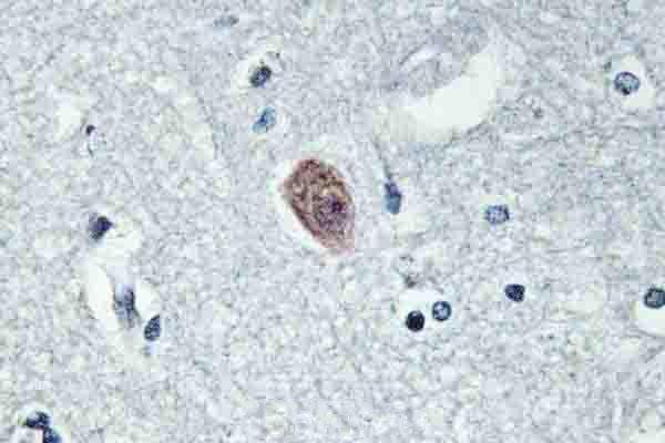 a13411 1 dok6 primary antiboties ihc testing 2