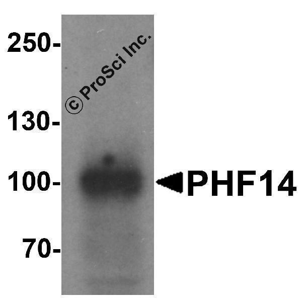 Immunofluorescence of PHF14 in 293 cells with PHF14 antibody at 5 μg/mL