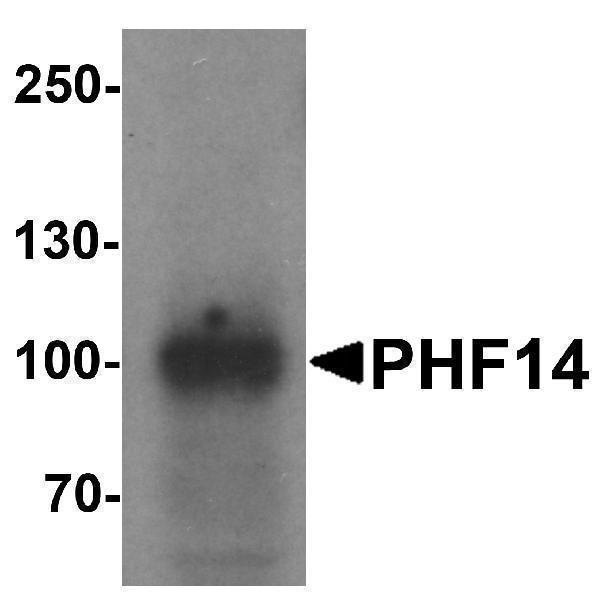 Western blot analysis of PHF14 in 293 cell lysate with PHF14 antibody at 1 μg/ml