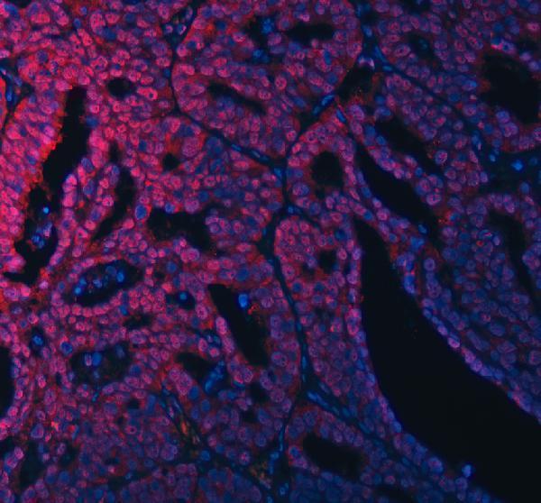 a13417 1 rsrc2 primary antibodies if testing 14