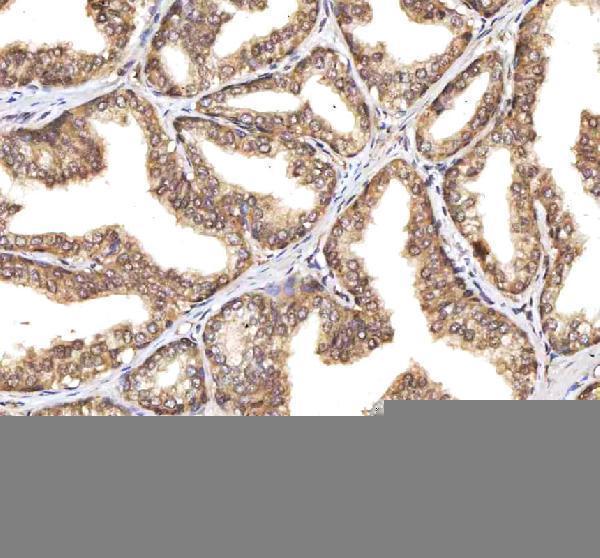 a13417 1 rsrc2 primary antibodies ihc testing 11
