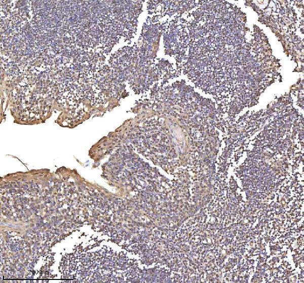 a13417 1 rsrc2 primary antibodies ihc testing 12