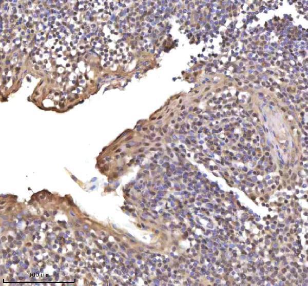 a13417 1 rsrc2 primary antibodies ihc testing 13