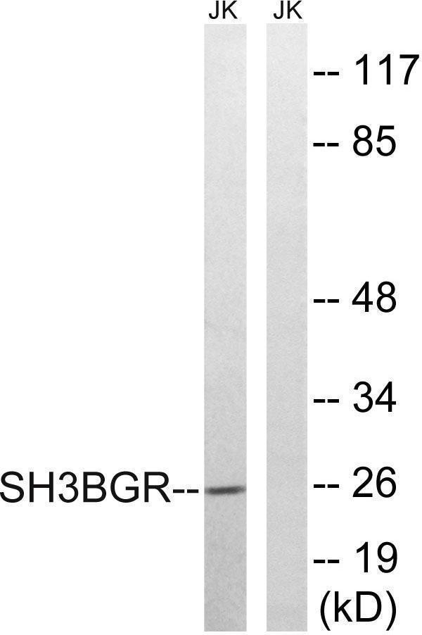 Western blot analysis of lysates from Jurkat cells, using SH3BGR Antibody