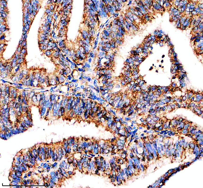 IHC analysis of SPCS2 using anti-SPCS2 antibody (A13430-1)